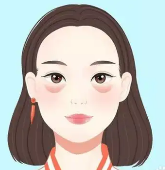去眼袋手术