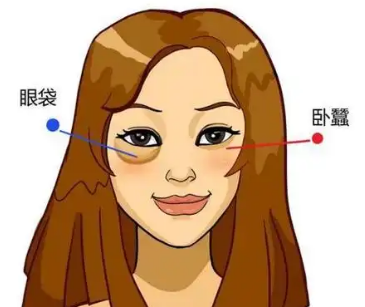 去眼袋手术