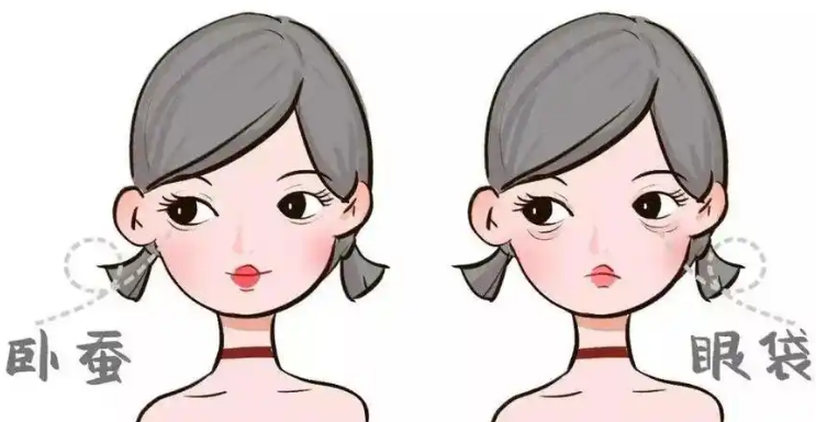 去眼袋手术