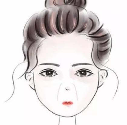 去眼袋手术