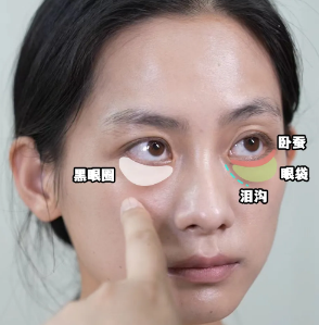 去眼袋手术