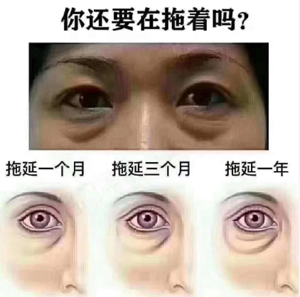 去眼袋手术