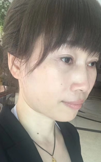 去眼袋手术