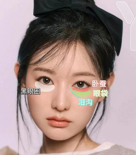去眼袋手术