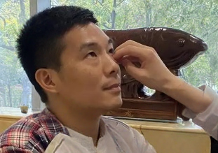 去眼袋手术