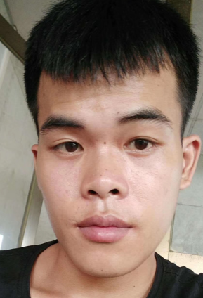 去眼袋手术