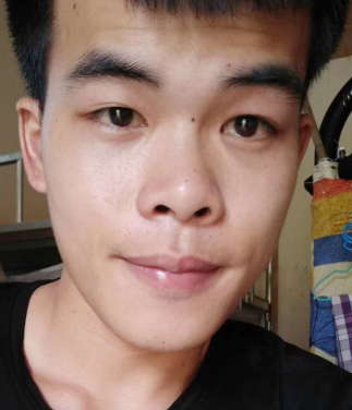 去眼袋手术