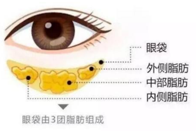 去眼袋手术