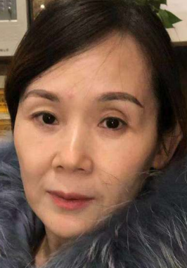 去眼袋手术