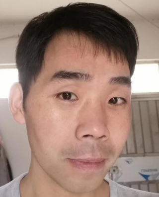 去眼袋手术