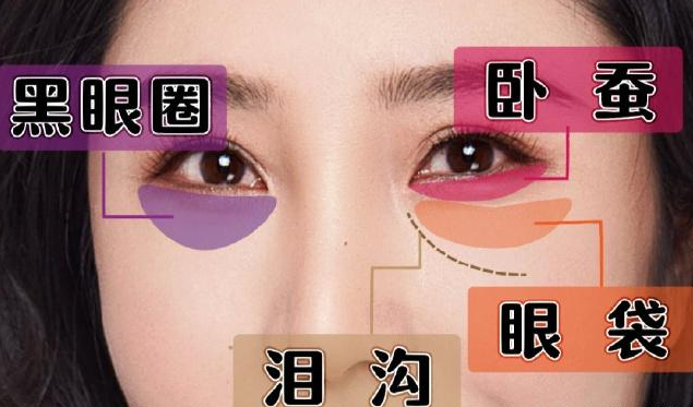 去眼袋手术