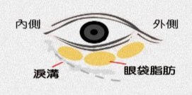 去眼袋手术