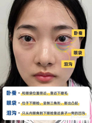 去眼袋手术
