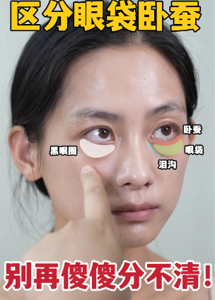 去眼袋手术
