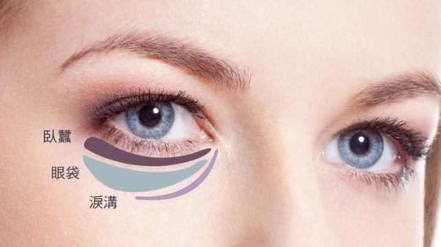 去眼袋手术