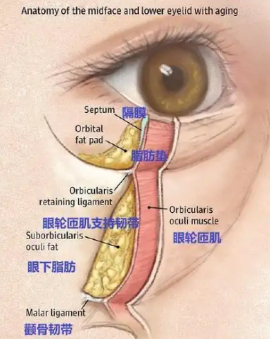 去眼袋手术