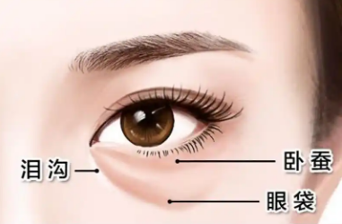 去眼袋手术