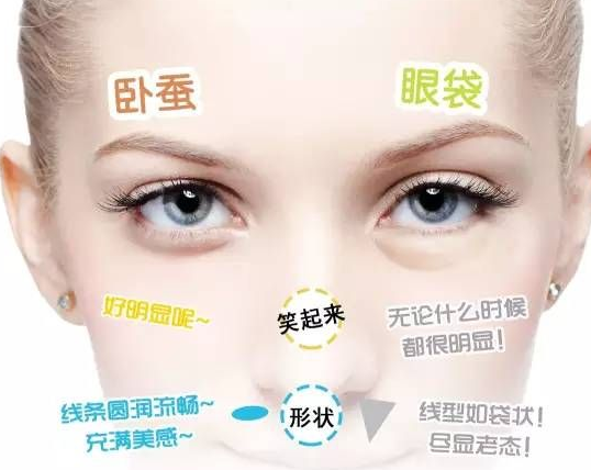 去眼袋手术