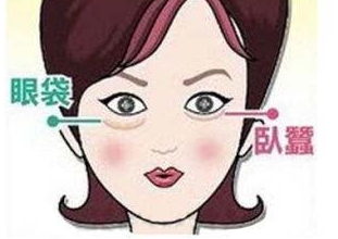 去眼袋手术