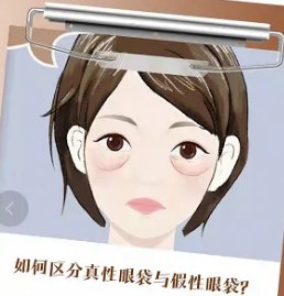 去眼袋手术