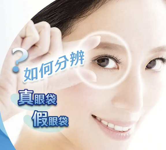 去眼袋手术