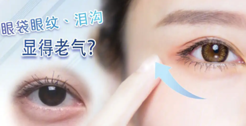 去眼袋手术