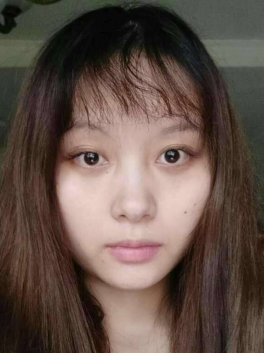 去眼袋手术