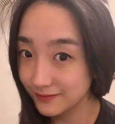 去眼袋手术
