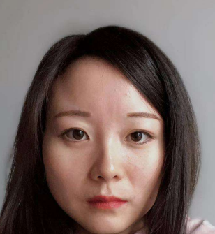 去眼袋手术