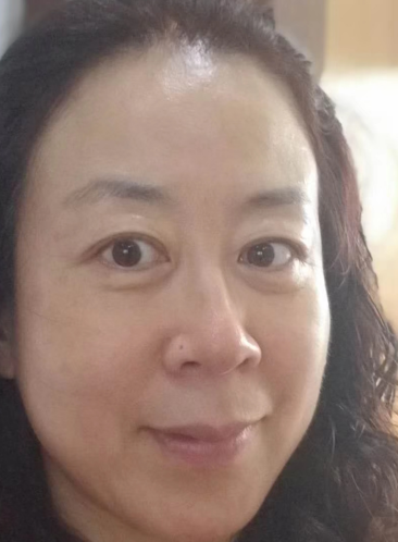 去眼袋手术
