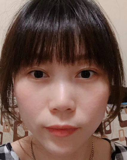 眼袋