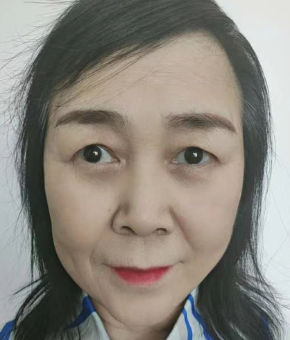 眼袋