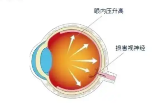 眼袋
