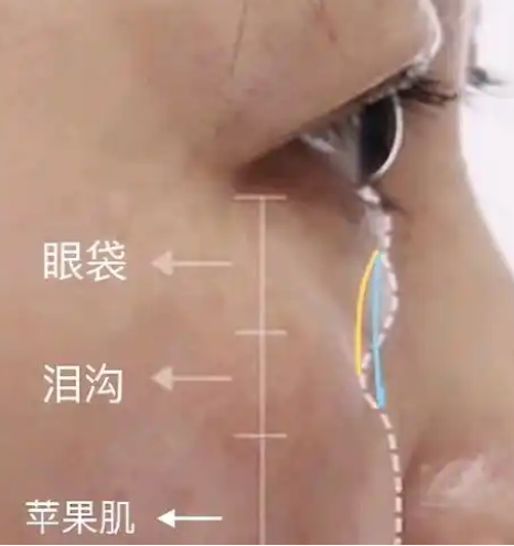 ۴
