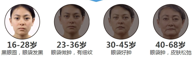 去眼袋手术