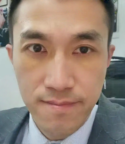 去眼袋手术