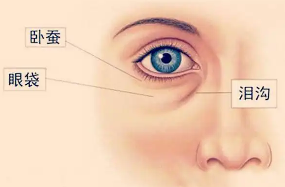 去眼袋手术
