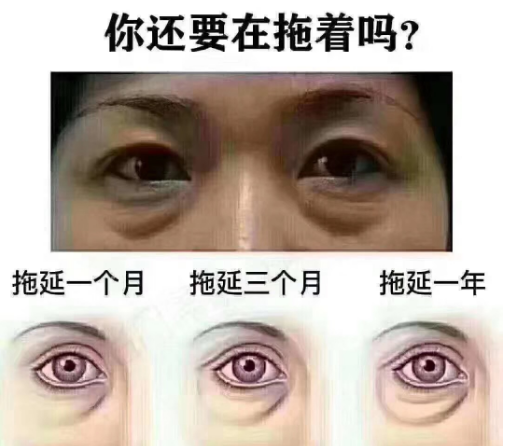 去眼袋手术