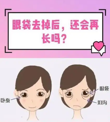 去眼袋手术