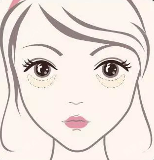 去眼袋手术
