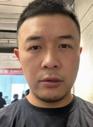 去眼袋手术