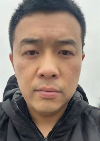 去眼袋手术
