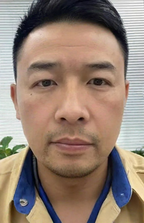 去眼袋手术
