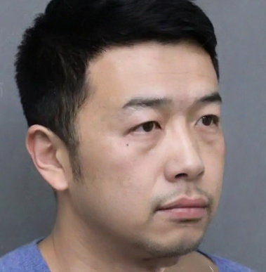 去眼袋手术