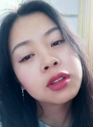 去眼袋手术