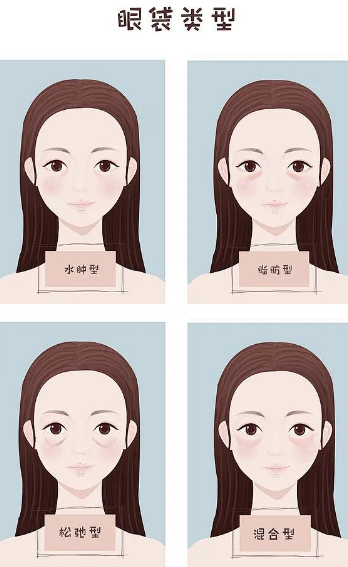 去眼袋手术
