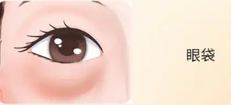 眼袋