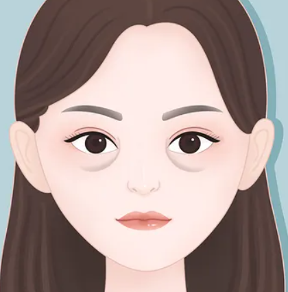 眼袋
