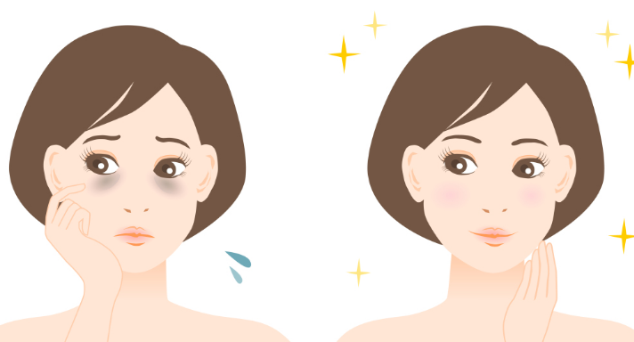 眼袋