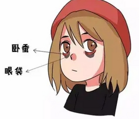去眼袋手术